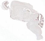 hnRNP A3 Antibody in Immunohistochemistry (Paraffin) (IHC (P))