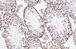 hnRNP A3 Recombinant Rabbit Monoclonal Antibody (HL5092)