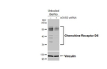CCRD6 Antibody in Western Blot (WB)