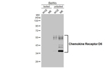 CCRD6 Recombinant Rabbit Monoclonal Antibody (HL5104)