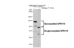 GPR110 Recombinant Rabbit Monoclonal Antibody (HL5109)