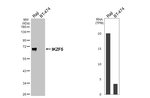 IKZF5 Recombinant Rabbit Monoclonal Antibody (HL5153)