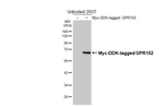 GPR152 Recombinant Rabbit Monoclonal Antibody (HL5168)