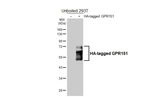 GPR151 Recombinant Rabbit Monoclonal Antibody (HL5261)
