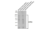 EDG6 Recombinant Rabbit Monoclonal Antibody (HL5307)