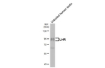 LHR Recombinant Rabbit Monoclonal Antibody (HL5339)