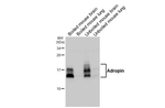 Adropin Antibody in Western Blot (WB)