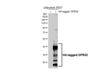 GPR52 Recombinant Rabbit Monoclonal Antibody (HL5461)