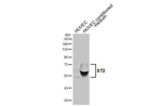 ST2 Antibody in Western Blot (WB)