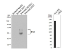 ST2 Recombinant Rabbit Monoclonal Antibody (HL5099)