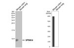 SPINK4 Recombinant Rabbit Monoclonal Antibody (HL5418)