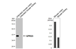 LPAR4 Antibody in Western Blot (WB)