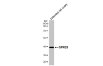 LPAR4 Antibody in Western Blot (WB)