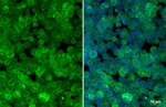 RAB27B Recombinant Rabbit Monoclonal Antibody (HL4987)