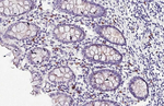 RAB27B Antibody in Immunohistochemistry (Paraffin) (IHC (P))