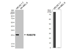 RAB27B Antibody in Western Blot (WB)