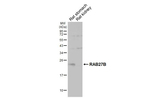 RAB27B Recombinant Rabbit Monoclonal Antibody (HL5044)