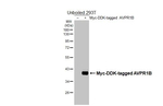 AVPR1B Recombinant Rabbit Monoclonal Antibody (HL5060)