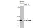 SLC4A4 Recombinant Rabbit Monoclonal Antibody (HL5250)