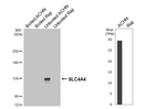 SLC4A4 Antibody in Western Blot (WB)