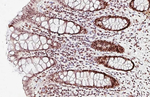 MSH6 Recombinant Rabbit Monoclonal Antibody (HL5070)