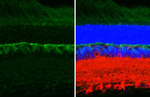 mGluR6 Antibody in Immunohistochemistry (Paraffin) (IHC (P))