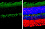 mGluR6 Antibody in Immunohistochemistry (Paraffin) (IHC (P))