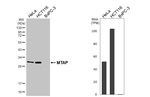 MTAP Recombinant Rabbit Monoclonal Antibody (HL5147)