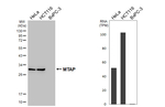 MTAP Recombinant Rabbit Monoclonal Antibody (HL5358)