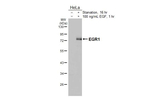 EGR1 Recombinant Rabbit Monoclonal Antibody (HL5183)