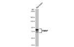 FMRP Antibody in Western Blot (WB)
