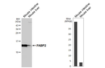 FABP2 Recombinant Rabbit Monoclonal Antibody (HL5114)