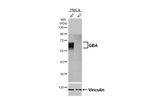 GBA Antibody in Western Blot (WB)