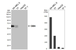 GBA Antibody in Western Blot (WB)