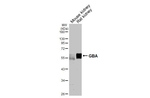 GBA Antibody in Western Blot (WB)