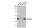 PCBP2 Recombinant Rabbit Monoclonal Antibody (HL5177)