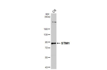 STIM1 Antibody in Western Blot (WB)