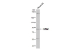 STIM1 Antibody in Western Blot (WB)