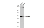 STIM1 Antibody in Western Blot (WB)