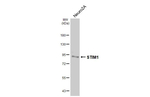 STIM1 Antibody in Western Blot (WB)