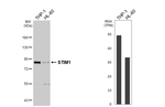 STIM1 Antibody in Western Blot (WB)