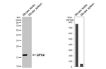 GPX4 Recombinant Rabbit Monoclonal Antibody (HL5229)