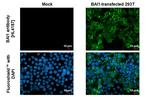 BAI1 Recombinant Rabbit Monoclonal Antibody (HL4187)