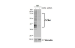 CCR4 Antibody in Western Blot (WB)