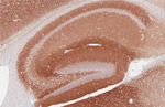 GABBR2 Antibody in Immunohistochemistry (Paraffin) (IHC (P))