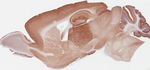GABBR2 Antibody in Immunohistochemistry (Paraffin) (IHC (P))