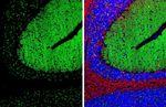 GABBR2 Antibody in Immunohistochemistry (Paraffin) (IHC (P))