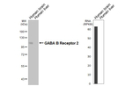 GABBR2 Antibody in Western Blot (WB)