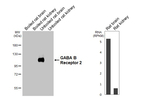 GABBR2 Antibody in Western Blot (WB)