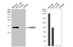 FABP5 Recombinant Rabbit Monoclonal Antibody (HL5052)